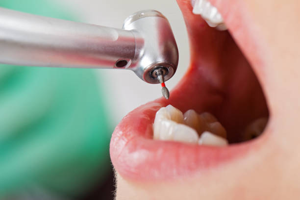 Best Urgent Care for Lost Fillings or Crowns in Brown Station, MD